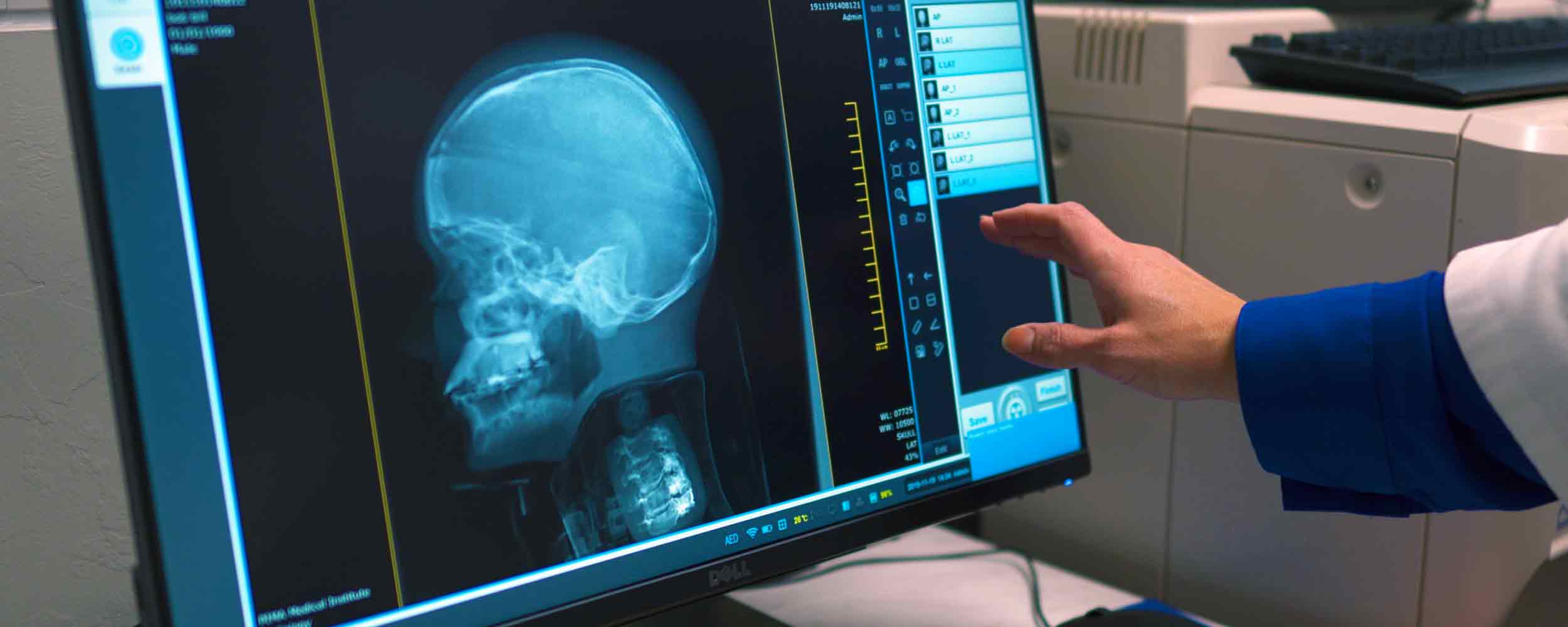 image of an x-ray on a monitor as an instructor selects options on a touchscreen